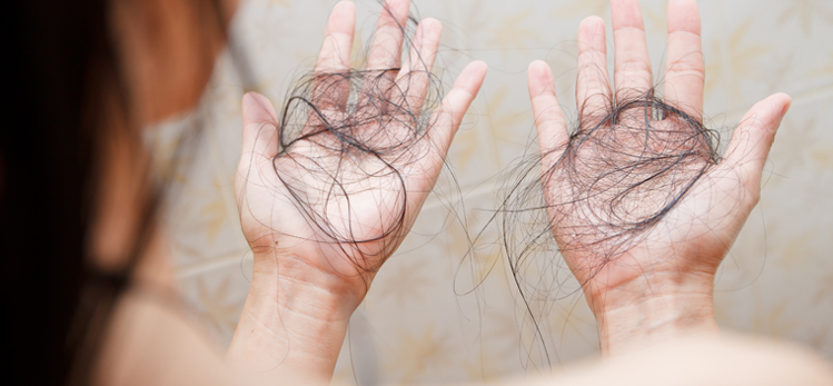 hair-falling-out-two-hands-after