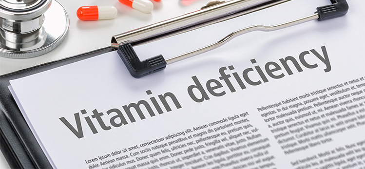 Role of Vitamin Deficiency in Hair Loss