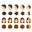 Androgenetic-alopecia