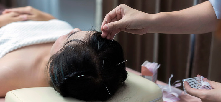 Does Acupuncture Really Regrow Hair?