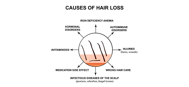 excessive hair loss after washing