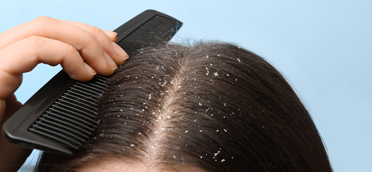itching and hair loss